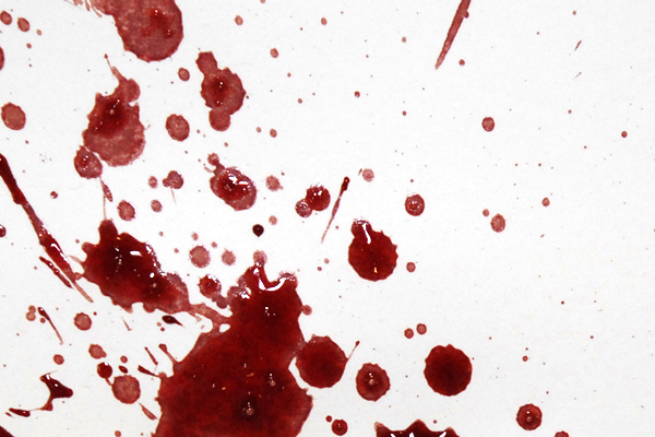 Bloodstain Example - Expiration Pattern