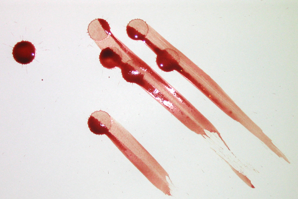 Bloodstain Example - Wipe Pattern