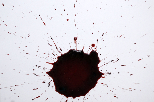 Bloodstain Example - Bloodstain