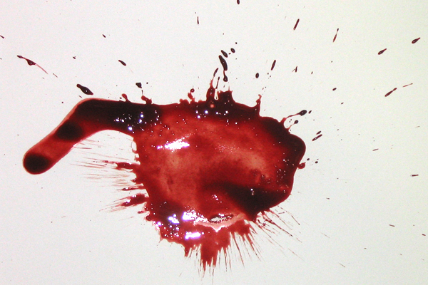 Bloodstain Example - Low Velocity Impact Spatter (LVIS)