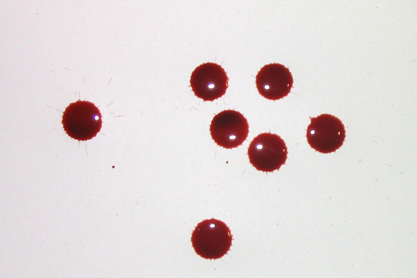 Bloodstain Example - Passive Drop